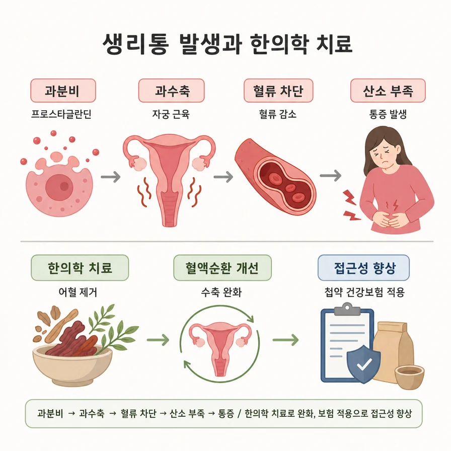 월경통 발생 과정과 한의학 치료를 정리한 그림. 프로스타글란딘 과분비, 자궁 근육 과수축, 혈류 감소, 산소 부족으로 통증이 생기며, 한의학 치료는 어혈 제거와 혈액순환 개선으로 수축을 완화하고 첩약 건강보험이 적용된다는 내용